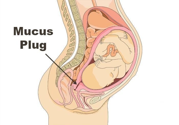 mucus plug